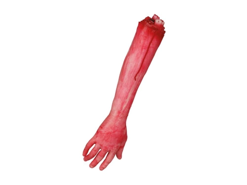 Amputated arm